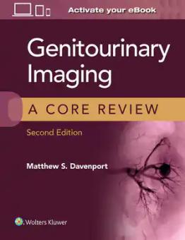 Genitourinary Imaging: A Core Review 