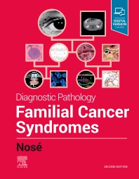 Diagnostic Pathology: Familial Cancer Syndromes 