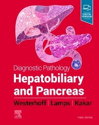 Diagnostic Pathology: Hepatobiliary and Pancreas 