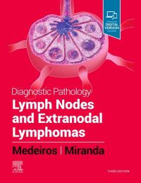 Diagnostic Pathology: Lymph Nodes and Spleen with Extranodal Lymphomas 