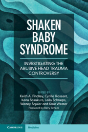 Shaken Baby Syndrome 