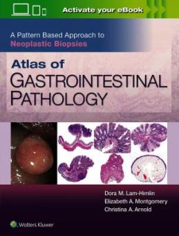 Atlas of Gastrointestinal Pathology / Neoplastic Biopsies 