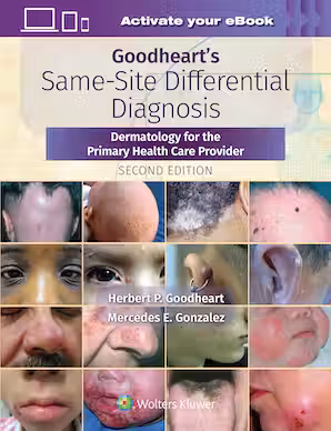 Goodheart's Same-Site Differential Diagnosis 