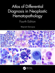 Atlas of Differential Diagnosis in Neoplastic Hematopathology 