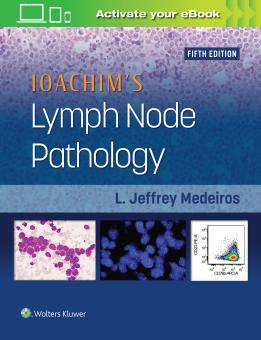 Ioachims Lymph Node Pathology 