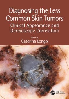 Diagnosing the Less Common Skin Tumors 