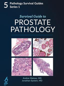 Survival Guide to Prostate Biopsies 