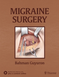 Migraine Surgery 