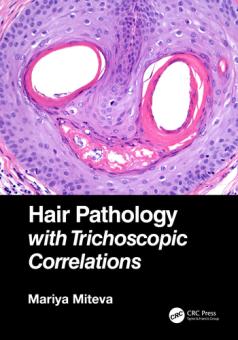 Hair Pathology with Trichoscopic Correlations 