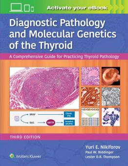 Diagnostic Pathology and Molecular Genetics of the Thyroid 