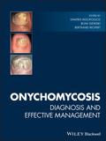 Onychomycosis 