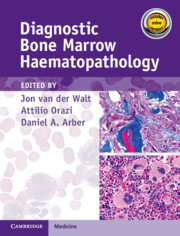 Diagnostic Bone Marrow Hematopathology 