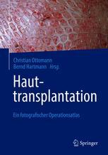 Hauttransplantation 