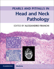 Pearls and Pitfalls in Head and Neck Pathology 