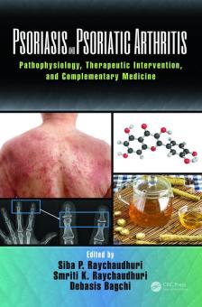 Psoriasis and Psoriatic Arthritis 