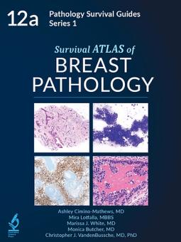 Survival ATLAS to Breast Pathology 