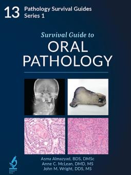 Survival Guide to Oral Pathology 