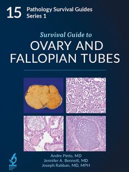 Survival Guide to Ovary and Fallopian Tubes 
