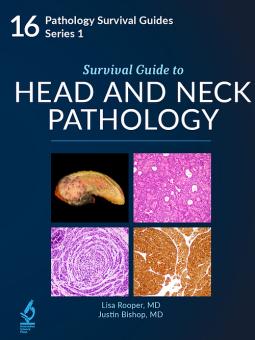 Survival Guide to Head and Neck Biopsies 