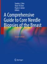 A Comprehensive Guide to Core Needle Biopsies of the Breast 