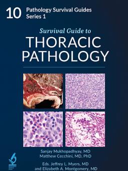 Survival Guide to Thoracic Pathology 