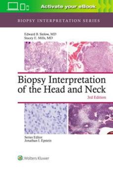 Biopsy Interpretation of the Head and Neck 