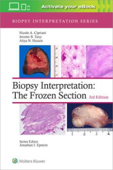 Biopsy Interpretation: The Frozen Section 