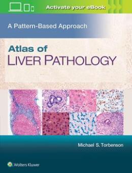 Atlas of Liver Pathology 
