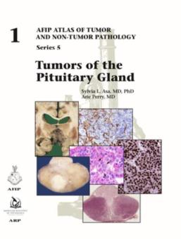 Tumors of the Pituitary Gland 