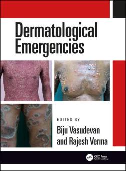 Dermatological Emergencies 