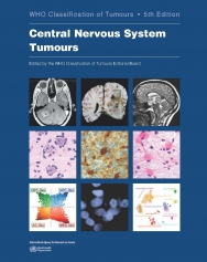 WHO Classification of Tumours: Central Nervous System Tumours 
