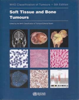 WHO Classification of Tumours: Soft Tissue and Bone Tumours 