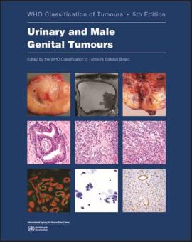 WHO Classification of Tumours: Urinary and Male Genital Tumours 